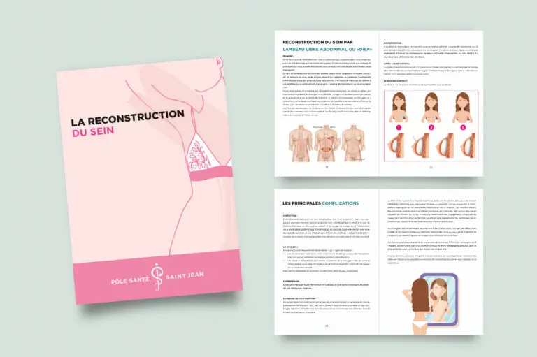 reconstruction du sein